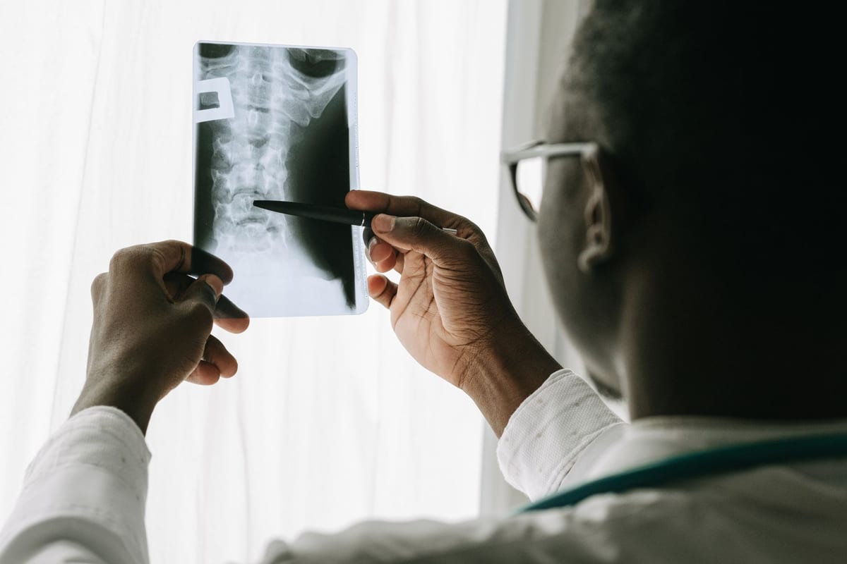 A clinician reading a cervical spine X-ray at the window